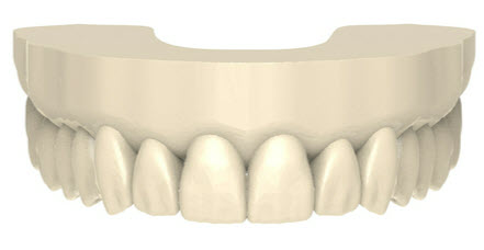 Aesthetic mockup of teeth