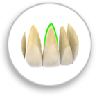 We use CT analysis to determine the position of roots