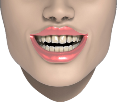 Digital smile design